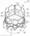 Fig. 01 - Prosthetic heart valve