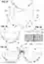 Fig. 08 - Prosthetic heart valve
