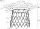 Fig. 01 - Stents with anchoring sections