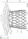 Fig. 03 - Stents with anchoring sections