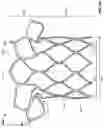 Fig. 05 - Stents with anchoring sections