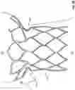 Fig. 06 - Stents with anchoring sections
