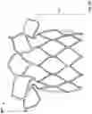 Fig. 07 - Stents with anchoring sections