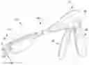 Fig. 01 - Pre-sized prosthetic chordae implantation system