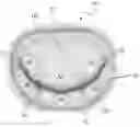 Fig. 01 - Method for generating a mitral repair ring, and mitral repair ring