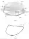 Fig. 10 - Method for generating a mitral repair ring, and mitral repair ring
