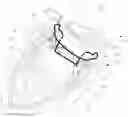 Fig. 01 - DEVICES AND IMPLANTATION METHODS FOR TREATING MITRAL VALVE CONDITION