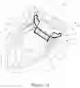 Fig. 02 - DEVICES AND IMPLANTATION METHODS FOR TREATING MITRAL VALVE CONDITION