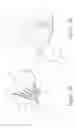 Fig. 16 - DEVICES AND IMPLANTATION METHODS FOR TREATING MITRAL VALVE CONDITION