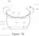 Fig. 20 - DEVICES AND IMPLANTATION METHODS FOR TREATING MITRAL VALVE CONDITION