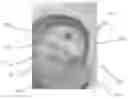 Fig. 01 - Device, system, and method for transcatheter treatment of valvular regurgitation