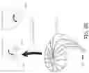 Fig. 20 - Device, system, and method for transcatheter treatment of valvular regurgitation
