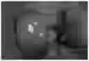 Fig. 01 - PATIENT SPECIFIC CARTILAGE DEFECT REPLACEMENT