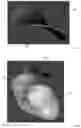 Fig. 02 - Prosthetic implant caps