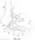 Fig. 07 - Elbow prosthesis
