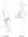 Fig. 14 - Elbow prosthesis