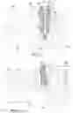 Fig. 16 - Elbow prosthesis
