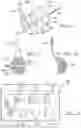 Fig. 18 - Elbow prosthesis