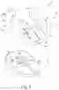 Fig. 02 - Total knee implant prosthesis assembly and method