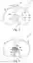 Fig. 06 - Total knee implant prosthesis assembly and method