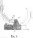 Fig. 08 - Total knee implant prosthesis assembly and method