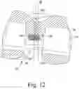 Fig. 11 - Total knee implant prosthesis assembly and method