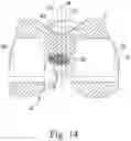 Fig. 13 - Total knee implant prosthesis assembly and method