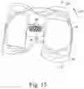 Fig. 14 - Total knee implant prosthesis assembly and method