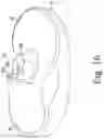 Fig. 15 - Total knee implant prosthesis assembly and method