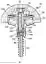 Fig. 01 - Baseplate of a modular shoulder joint prosthesis and related methods for implanting the same