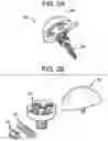 Fig. 03 - Baseplate of a modular shoulder joint prosthesis and related methods for implanting the same