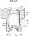 Fig. 06 - Baseplate of a modular shoulder joint prosthesis and related methods for implanting the same