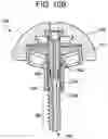 Fig. 13 - Baseplate of a modular shoulder joint prosthesis and related methods for implanting the same