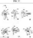 Fig. 15 - Baseplate of a modular shoulder joint prosthesis and related methods for implanting the same