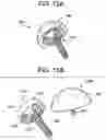 Fig. 18 - Baseplate of a modular shoulder joint prosthesis and related methods for implanting the same