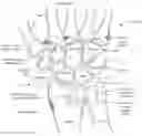 Fig. 01 - Patient specific carpal implant