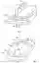 Fig. 02 - Transforaminal prosthetic spinal disc apparatus