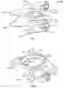 Fig. 05 - Transforaminal prosthetic spinal disc apparatus
