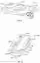 Fig. 07 - Transforaminal prosthetic spinal disc apparatus