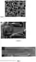 Fig. 02 - Device to be implanted in human or animal tissue and method for implanting and assembling the device