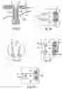 Fig. 08 - Device to be implanted in human or animal tissue and method for implanting and assembling the device