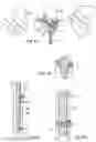 Fig. 12 - Device to be implanted in human or animal tissue and method for implanting and assembling the device