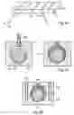 Fig. 16 - Device to be implanted in human or animal tissue and method for implanting and assembling the device