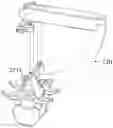 Fig. 01 - Devices and methods for inter-vertebral orthopedic device placement