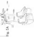 Fig. 03 - Devices and methods for inter-vertebral orthopedic device placement