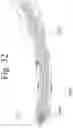 Fig. 34 - Devices and methods for inter-vertebral orthopedic device placement