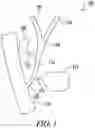 Fig. 02 - Biliary stent