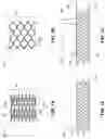 Fig. 02 - Thin-film micromesh and related methods