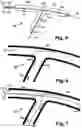 Fig. 04 - Stent system deployment method for bifurcated lesion