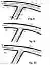 Fig. 05 - Stent system deployment method for bifurcated lesion